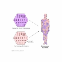 Genetics of CDKL5